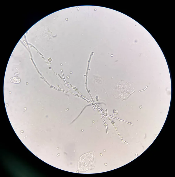 Budding Jästceller Med Pseudohyf Urinprov Hitta Med Mikroskop 40X — Stockfoto