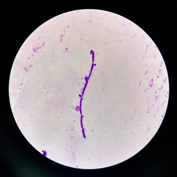 Células Levadura Ciernes Con Pseudohifas Orina Hallazgo Muestra Con Microscopio —  Fotos de Stock