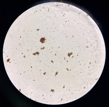 Kırmızı kan hücresi birleşimi uyumlu olmayan kan bankası laboratuvarı eşleşmesi.