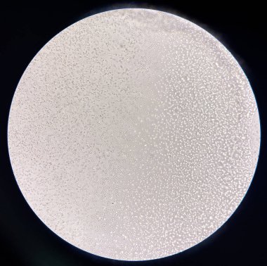 Kırmızı kan hücresi aglütinasyon eksikliği uyumlu donör kan bankası laboratuvarı.