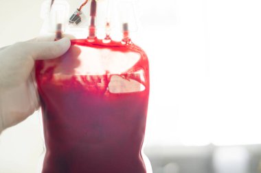 Elinde kan torbası, kan bankası laboratuvarı..