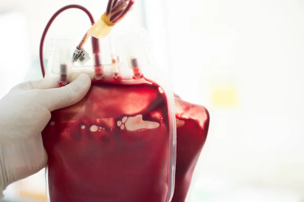 Bloedzak Hand Wetenschappelijk Bloedbank Laboratorium — Stockfoto