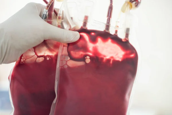 Bloedzak Hand Wetenschappelijk Bloedbank Laboratorium — Stockfoto