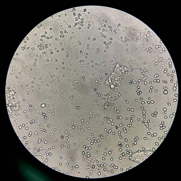 Кругла Товста Стінка Дріжджової Клітини Бінарне Ділення — стокове фото