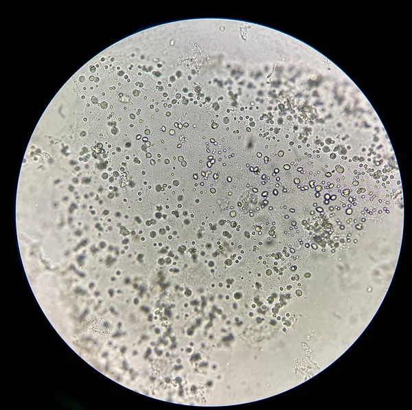 Round thick wall yeast cell.Binary fission.