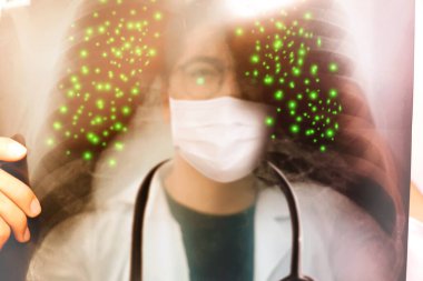 Covid-19 kavramı: Görüntü bulanıklığı: Erkek doktor Corona virüsü (Covid-19) olan hastaların göğüs röntgenini inceledi ve solunum yolunun yayıldığını buldu: