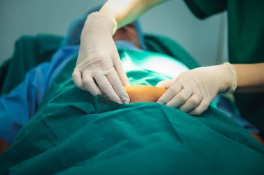 Şişman kadın hastaların karın yağlarını tutmak için elini kullanan kadın doktor, şişmanlıktan kaynaklanan karın yağlarını azaltma ameliyatından insanlara sağlık ve cerrahi konseptine kadar tedavi gördü..