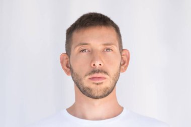 Sarkık kulaklı, koca kulaklı bir adam. Kulak kusuru. Estetik ameliyattan önceki hasta. Ototlasti bekleniyor.