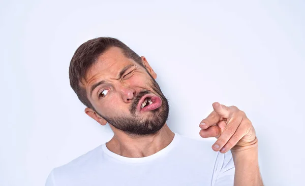 Een man met zenuwproblemen. Man met gezichtszenuw stoornis — Stockfoto