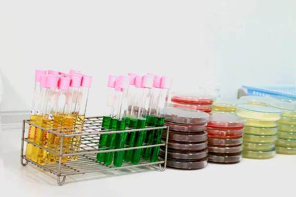 Colorful Fluid Culture Medium Petri Dish Test Tube Glassware Growing — Stock Photo, Image