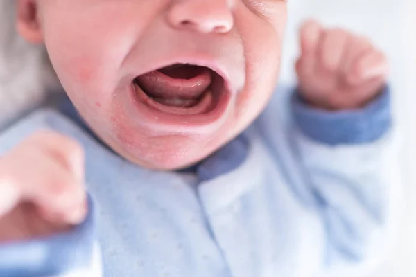 Portrait Crying Newborn Discomfort Baby Colic Belly Concept Health Care — Stock Photo, Image