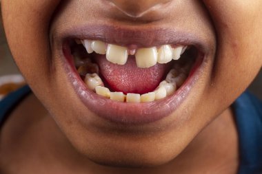 Asyalı çocuk gülümse ve dişlerini göster.