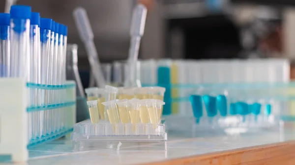 Epidemiyoloji Merkezlerinde Koronavirüs Tedavisi Için Sayısız Test Tüpü Kullanılır Covid — Stok fotoğraf