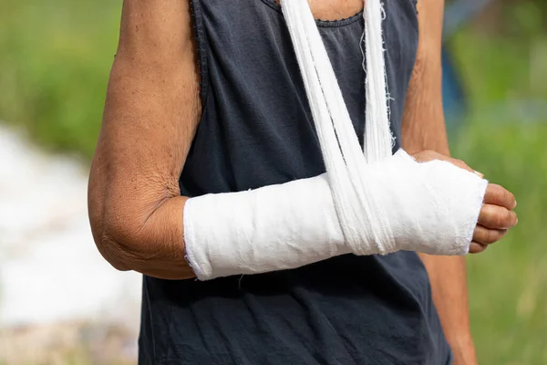 Old Woman Broken Arm Sling Close Hand Bandage Gypsum Body — Stock Photo, Image