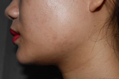 Güneydoğu Asyalı şişman çene ve çene yağları, Myanmar güzel genç kadın. İki çeneyi birbirine yaklaştırıyor.