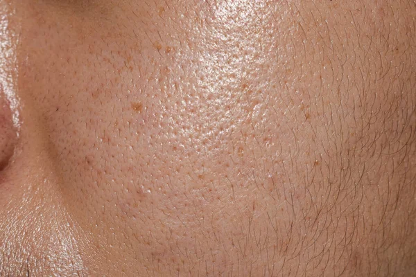 Fair skin with wide pores in face of Southeast Asian, Myanmar or Korean adult young man.