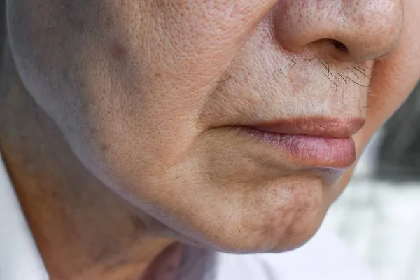 Hautfalten Und Falten Gesicht Eines Asiatischen Älteren Mannes — Stockfoto