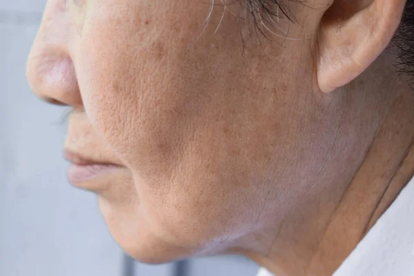 Enlarged Pores Face Southeast Asian Chinese Elder Man Skin Folds — Stock Photo, Image