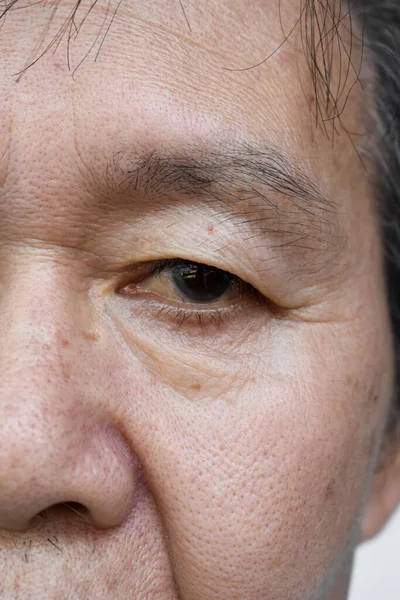 Vincos Pele Torno Olho Asiático Mais Velho Homem Mostrando Envelhecimento — Fotografia de Stock