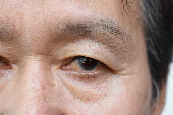 Δέρμα Τσαλακώνεται Γύρω Από Μάτι Του Ηλικιωμένου Ασιάτη Που Δείχνει — Φωτογραφία Αρχείου
