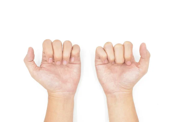 Dedos Articulações Mãos Saúde Conceito Cuidados Com Mãos — Fotografia de Stock