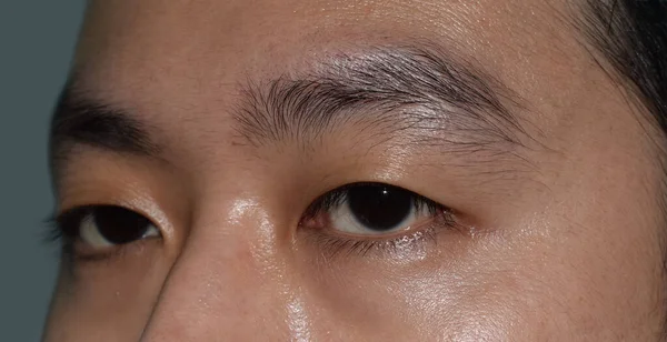 동남아시아에서는 눈꺼풀 하나나단 두증을 중국인 청년이었습니다 모놀드 Monolid 아래에 보이는 — 스톡 사진