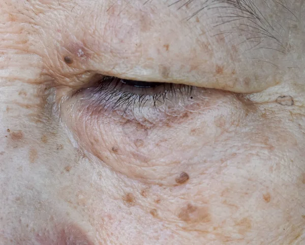 Yaşlanan cilt kıvrımları, cilt kırışıklıkları, kırışıklıkları ve yüzlerindeki yaşlanma noktaları özellikle Güneydoğu Asyalı, Çinli yaşlı kadınların gözlerinde. Yakın görünüm.