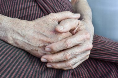 Clasped hands of Asian Myanmar or Burmese elder man. Concept of rheumatoid arthritis, osteoarthritis or joint pain. clipart