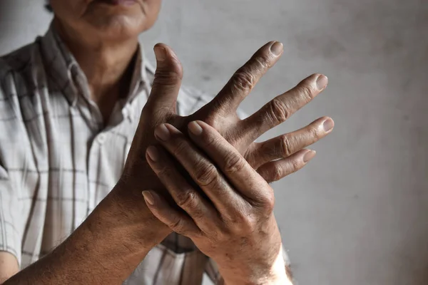Inflammation Des Orteils Jeunes Hommes Asiatiques Concept Douleur Articulaire Pied — Photo