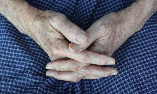 Las Manos Apretadas Del Viejo Asiático Myanmar Concepto Artritis Reumatoide —  Fotos de Stock