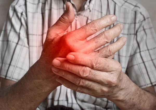 Güneydoğu Asyalı Yaşlı Adamın Elinde Acı Ağrısı Eklem Iltihabı Eklem — Stok fotoğraf