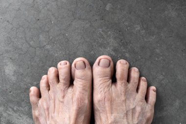 Asyalı yaşlı kadının ayakları. Ayak ve ayak parmakları sağlığı ve ince deri kavramı. Somut arka planda izole edilmiş.