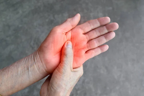 Painful Palmar Aspect Asian Old Woman Concept Compartment Syndrome Cellulitis — Stock Photo, Image