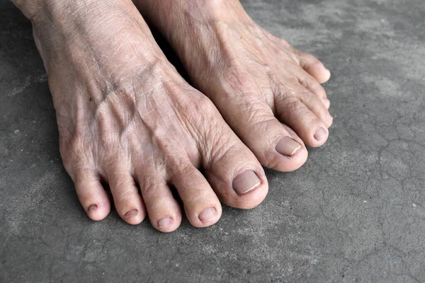 Feet Asian Elder Woman Concept Foot Toes Health Thin Skin — Stockfoto