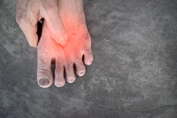 Επώδυνο Πόδι Ασιάτη Γέρου Διαβήτη Προβλήματα Αισθητηριακής Νευροπάθειας Προβλήματα Νεύρων — Φωτογραφία Αρχείου
