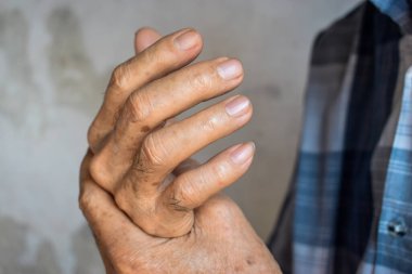 Asyalı yaşlı adamın elleri ve parmakları. El ağrısı, romatizma, eklem iltihabı, parmak sağlığı ve sorunlar kavramı..