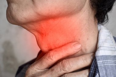 Redness at neck of Asian old man. Concept of sore throat, pharyngitis, laryngitis or dysphagia. clipart