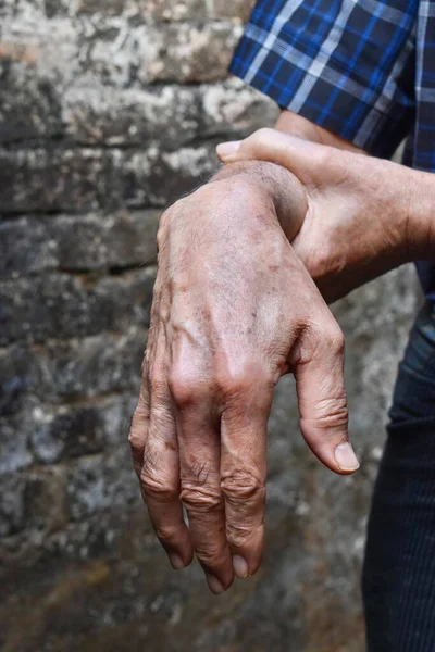 Lesão Nervo Radial Queda Pulso Homem Mais Velho Asiático — Fotografia de Stock