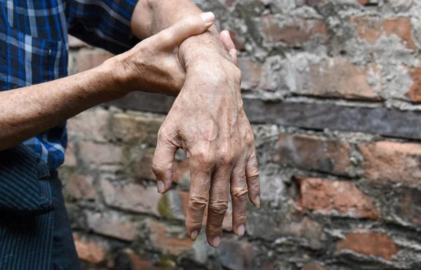 Lesión Del Nervio Radial Caída Muñeca Del Anciano Asiático —  Fotos de Stock