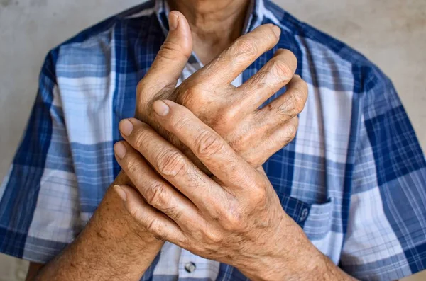 Fingers and hands of Asian elder man. Concept of hand pain, rheumatoid arthritis and finger problems. Front view.