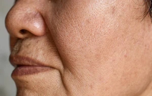 Vergrößerte Poren Gesicht Des Südostasiatischen Chinesischen Älteren Mannes Mit Hautfalten — Stockfoto