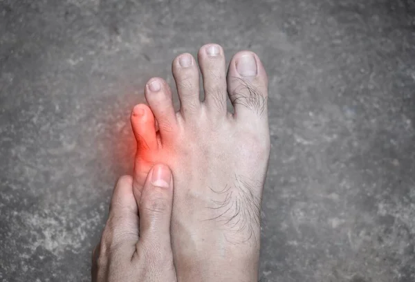 Fájdalmas Kis Ázsiai Fiatalember Lábujja Törött Lábujj Törött Lábujj Benőtt — Stock Fotó