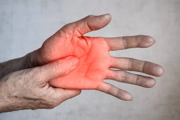 Aspecto Palmar Doloroso Del Anciano Asiático Concepto Síndrome Compartimental Celulitis — Foto de Stock