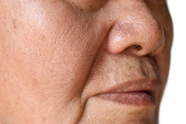 Enlarged Pores Face Southeast Asian Chinese Elder Man Skin Folds — Stock Photo, Image