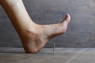 Asyalı genç bir adamın ayağında çivi batması. Tetanos kavramı.