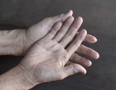 İki elinde soluk avuç içi yüzeyi. Çinli, Asyalı yaşlı adamın kansız elleri..