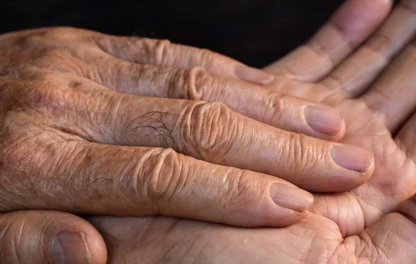 Fingers of Asian elder man. Concept of hand pain, arthritis and finger problems.