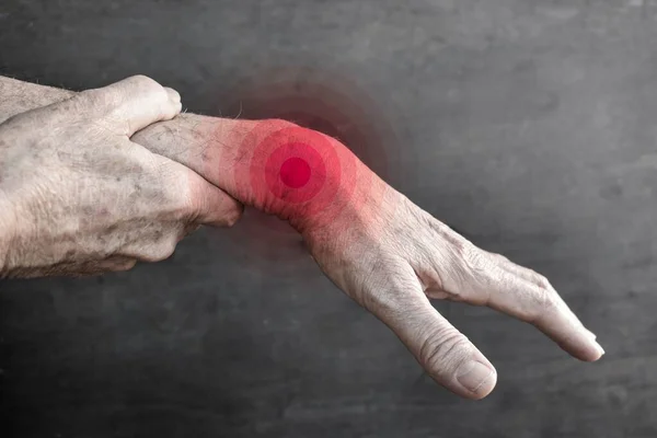 东南亚老年人腕关节疼痛 类风湿关节炎及手臂问题的概念 — 图库照片