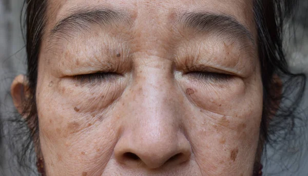 Wajah Wanita Tua Asia Tenggara Dengan Mata Tertutup Konsep Penuaan — Stok Foto