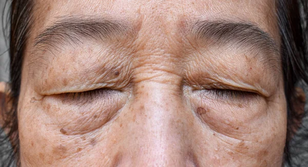 Falten Das Geschlossene Auge Einer Asiatischen Älteren Frau Nahaufnahme — Stockfoto